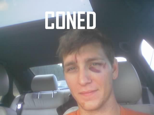 cone20injury1.jpg 